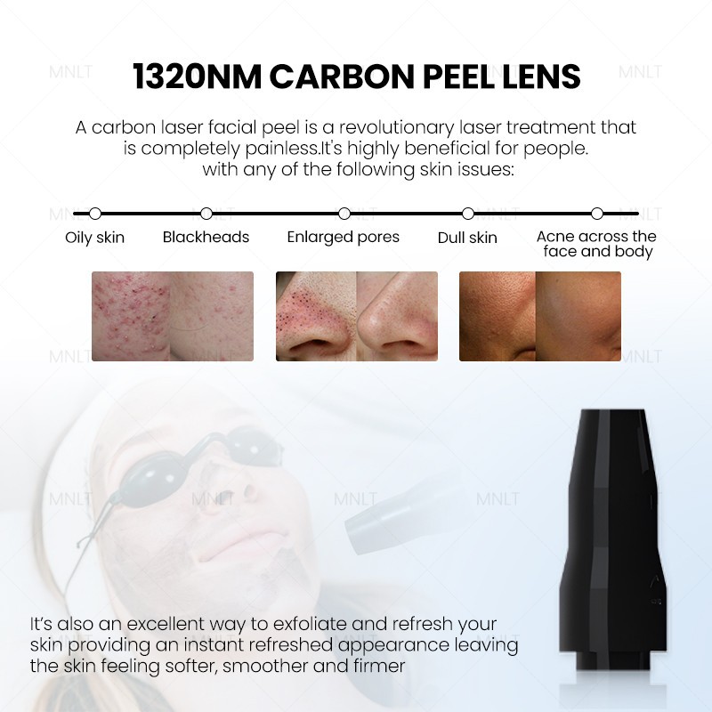 Portable Nd:YAG Laser Machine For Tattoo Removal & Skin Rejuvenation price