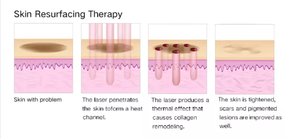 skin theory skin theory