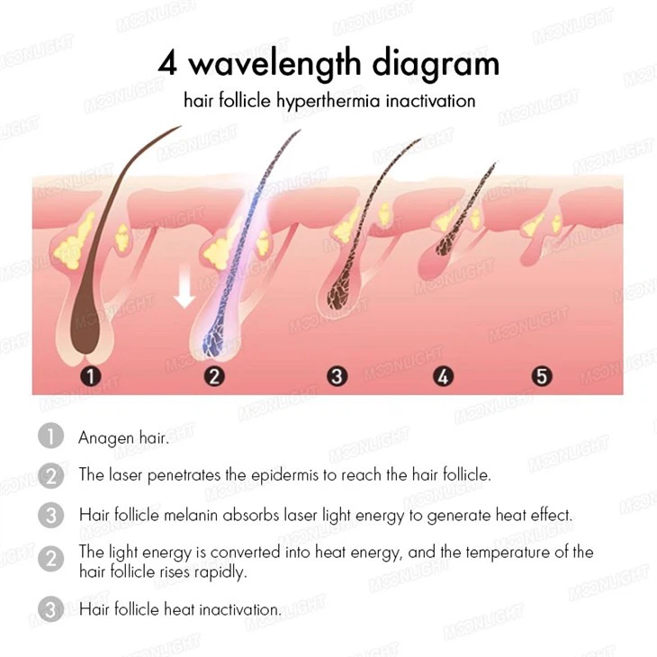 4 Wave Diode Laser Hair Removal Machine