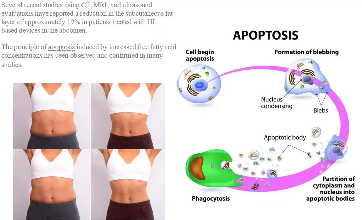 Best Ems Body Sculpt Machine