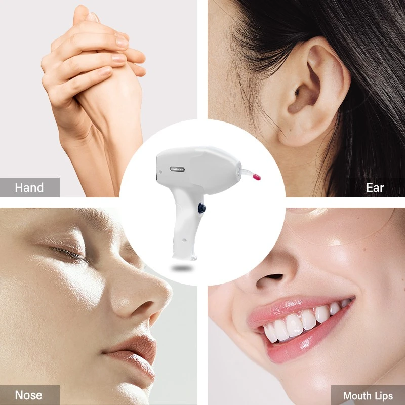 AI-Powered Diode Laser Hair Removal Machine