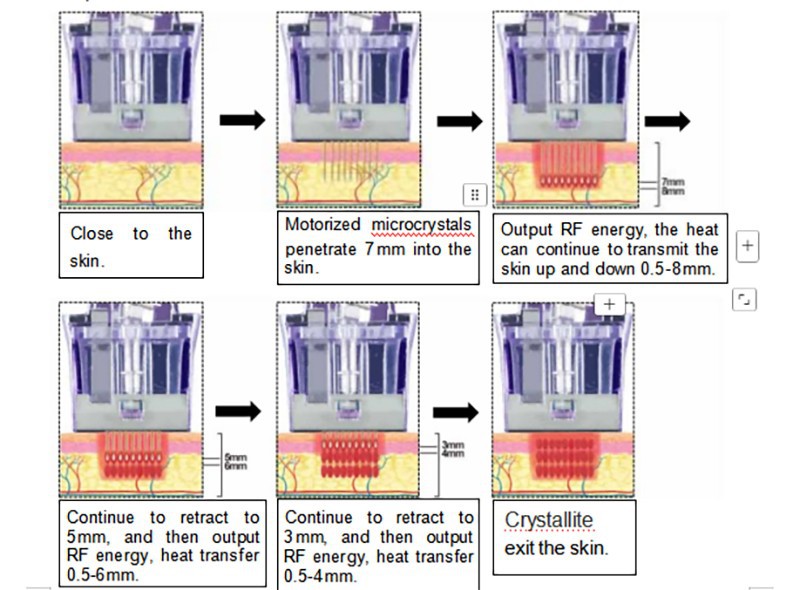 Crystallite Depth 8 RF Microneedling System factory