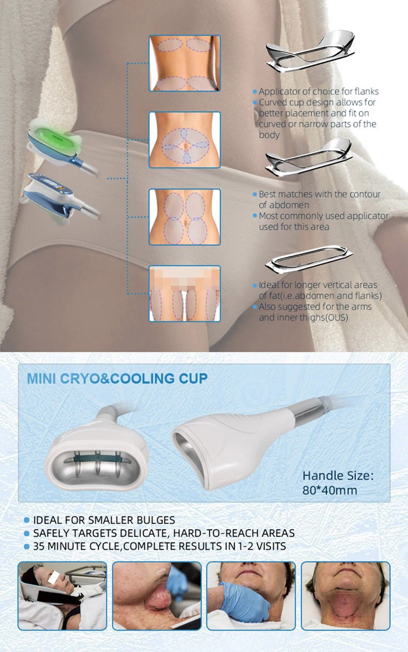 MNLT 360° Cryolipolysis Slimming Machine factory