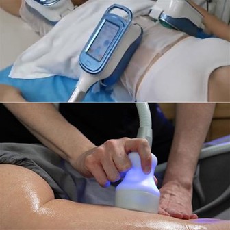 Coolsculpting masina hind