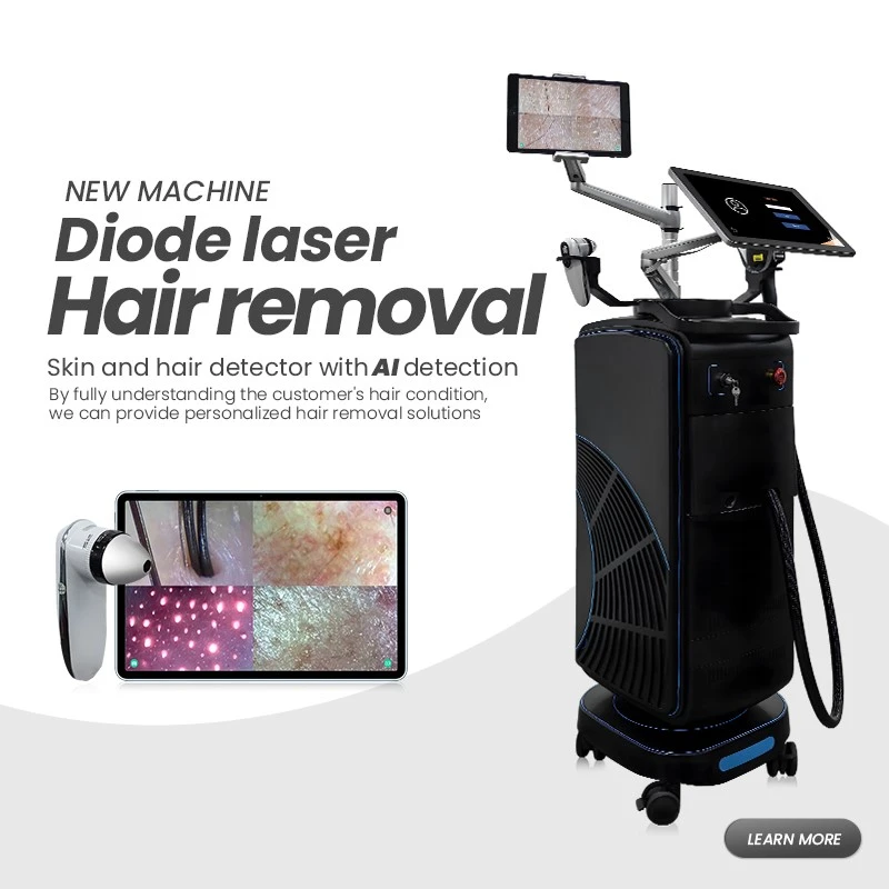 AI professional laser hair removal machine AI professional laser hair removal machine