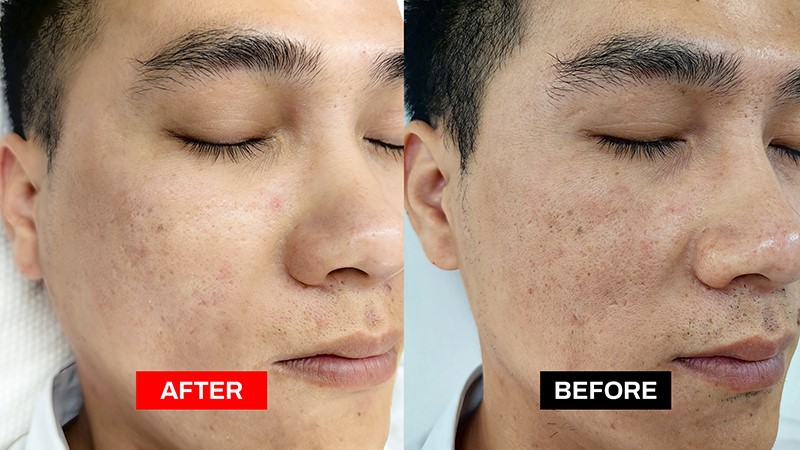 effect 1-1 effect 1-1