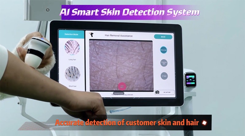 Professional Diode Laser Hair Removal Device Supplier